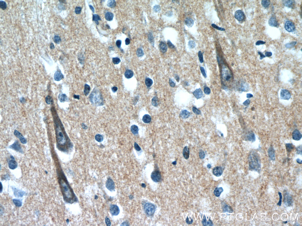 Immunohistochemistry of paraffin-embedded human brain slide using 23108-1-AP( XRN1 Antibody) at dilution of 1:50