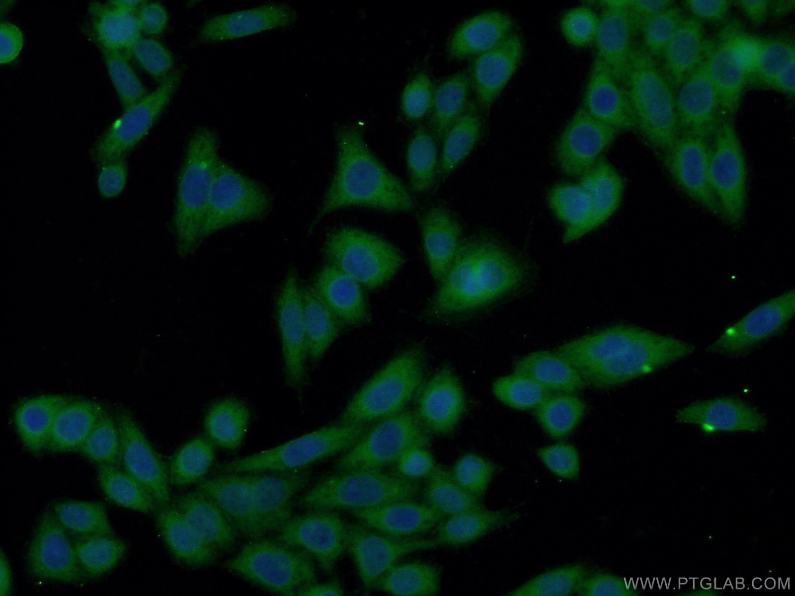 Immunofluorescent analysis of HeLa cells using 23108-1-AP( XRN1 Antibody) at dilution of 1:50 and Alexa Fluor 488-congugated AffiniPure Goat Anti-Rabbit IgG(H+L)
