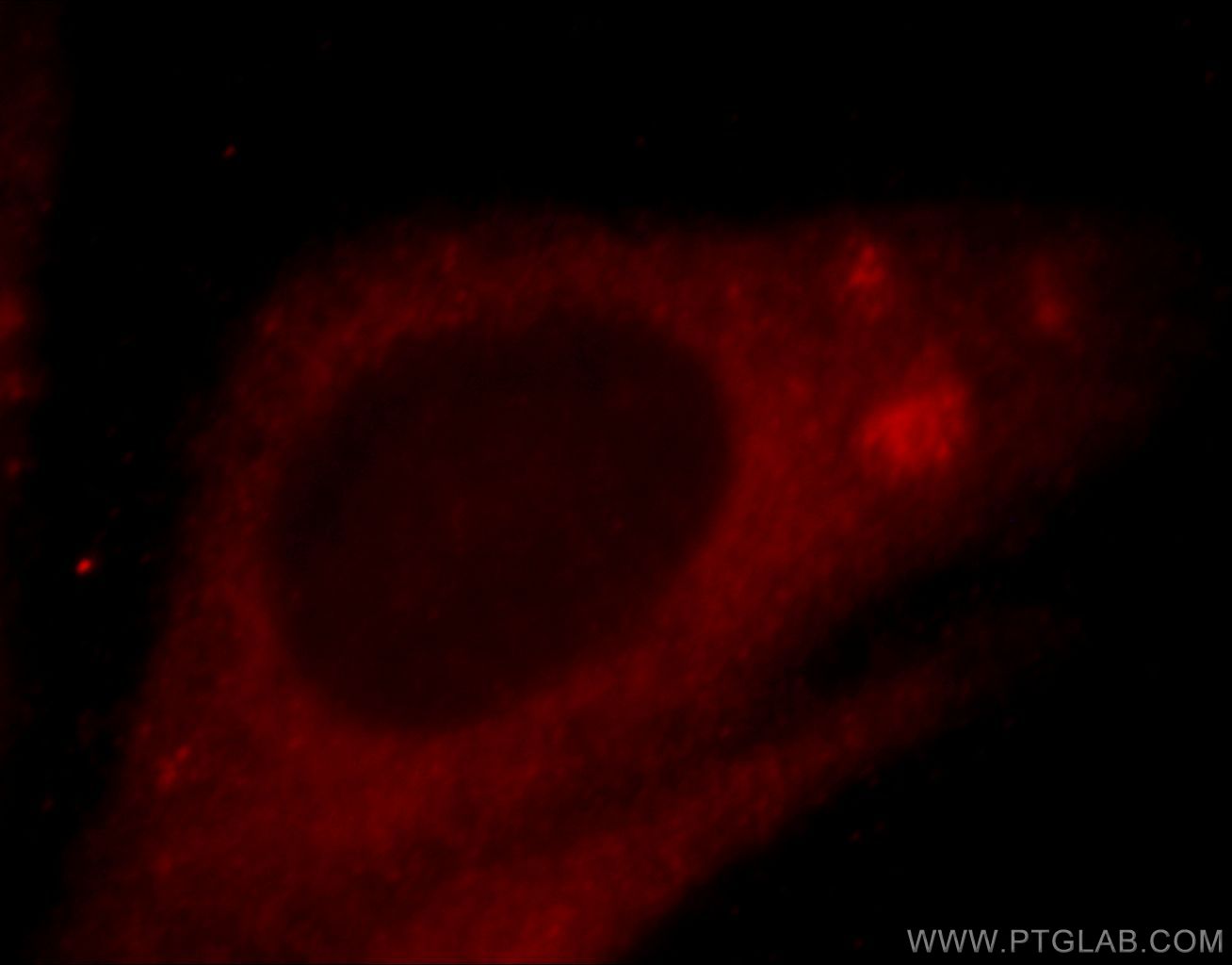 Immunofluorescent analysis of HepG2 cells, using ZNF839 antibody 20539-1-AP at 1:25 dilution and Rhodamine-labeled goat anti-rabbit IgG (red).