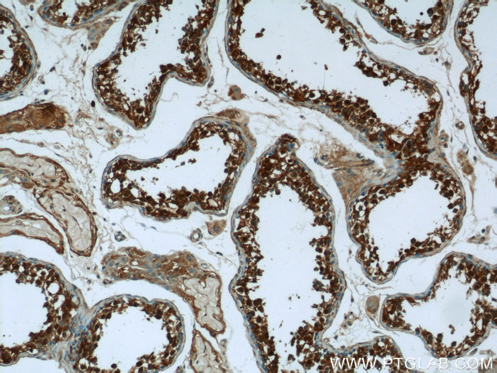Immunohistochemistry of paraffin-embedded human testis tissue slide using 24525-1-AP( DHX57 Antibody) at dilution of 1:50 (under 10x lens)