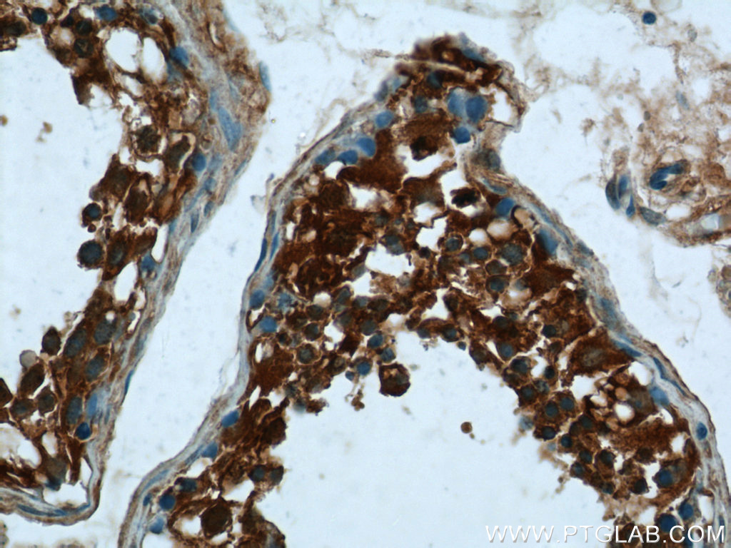 Immunohistochemistry of paraffin-embedded human testis tissue slide using 24525-1-AP( DHX57 Antibody) at dilution of 1:50 (under 40x lens)
