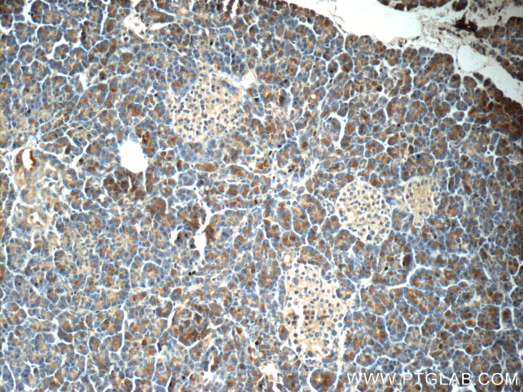 Immunohistochemistry of paraffin-embedded human pancreas tissue slide using 23411-1-AP( DNAJC21 Antibody) at dilution of 1:50 (under 10x lens)