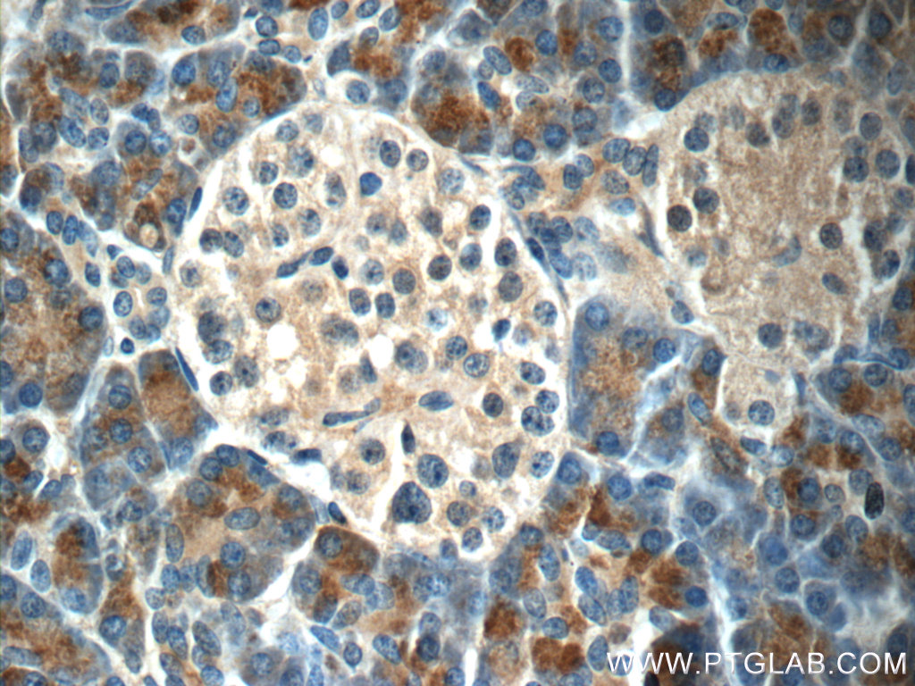 Immunohistochemistry of paraffin-embedded human pancreas tissue slide using 23411-1-AP( DNAJC21 Antibody) at dilution of 1:50 (under 40x lens)