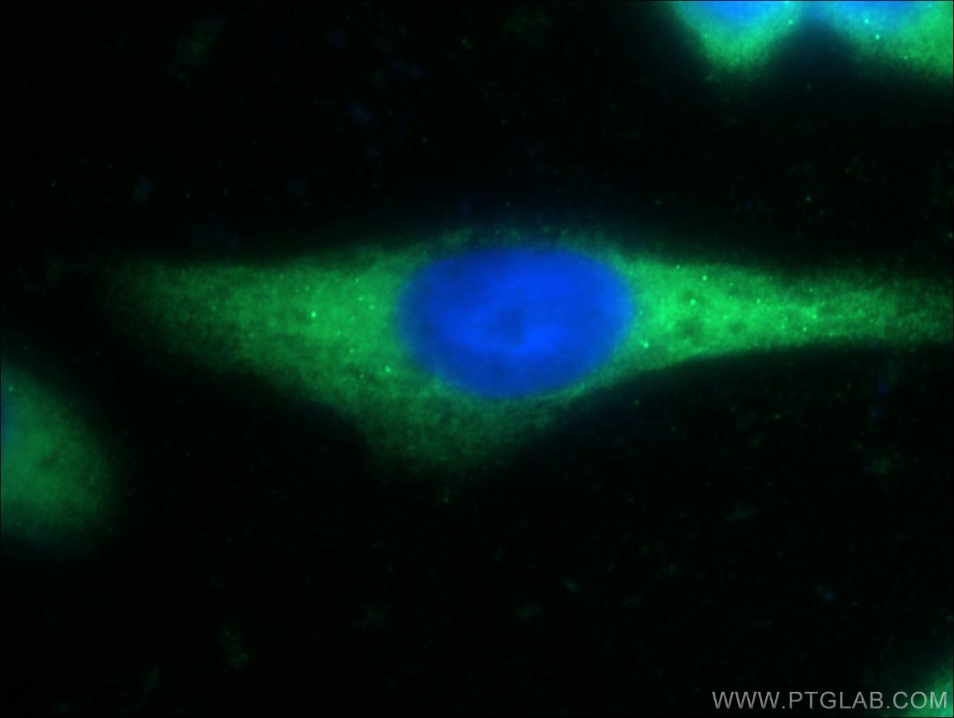 Immunofluorescent analysis of HeLa cells using 23411-1-AP( DNAJC21 Antibody) at dilution of 1:50 and Alexa Fluor 488-congugated AffiniPure Goat Anti-Rabbit IgG(H+L)