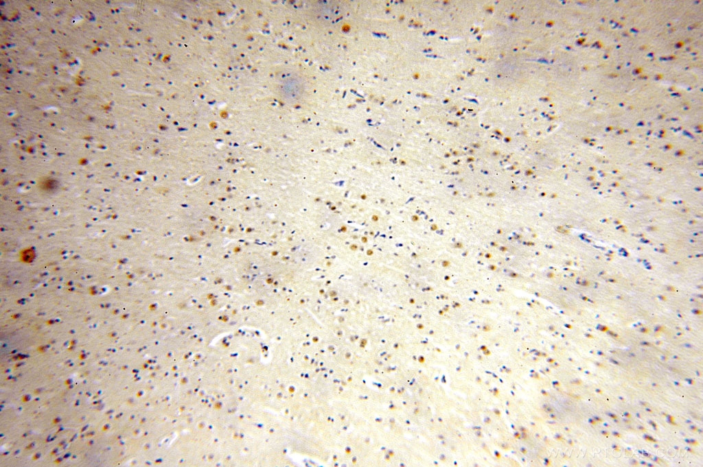 Immunohistochemical of paraffin-embedded human brain using 17147-1-AP(FAM160B2 antibody) at dilution of 1:100 (under 10x lens)