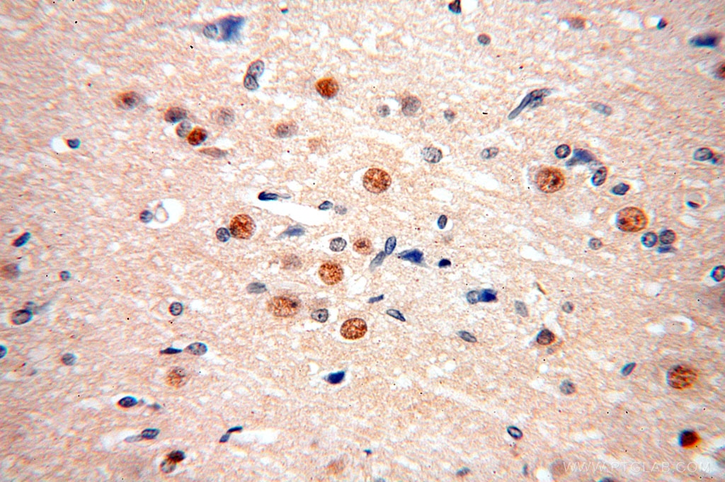 Immunohistochemical of paraffin-embedded human brain using 17147-1-AP(FAM160B2 antibody) at dilution of 1:100 (under 40x lens)