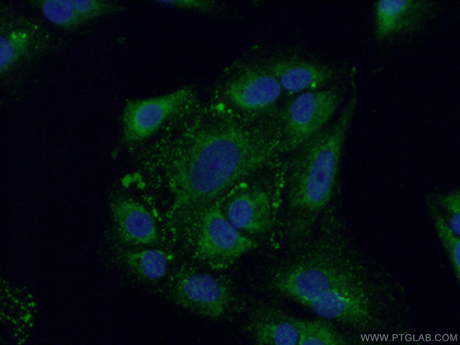 Immunofluorescent analysis of ( -20℃ Ethanol ) fixed A549 cells using 17147-1-AP( FAM160B2 Antibody) at dilution of 1:50 and Alexa Fluor 488-congugated AffiniPure Goat Anti-Rabbit IgG(H+L)