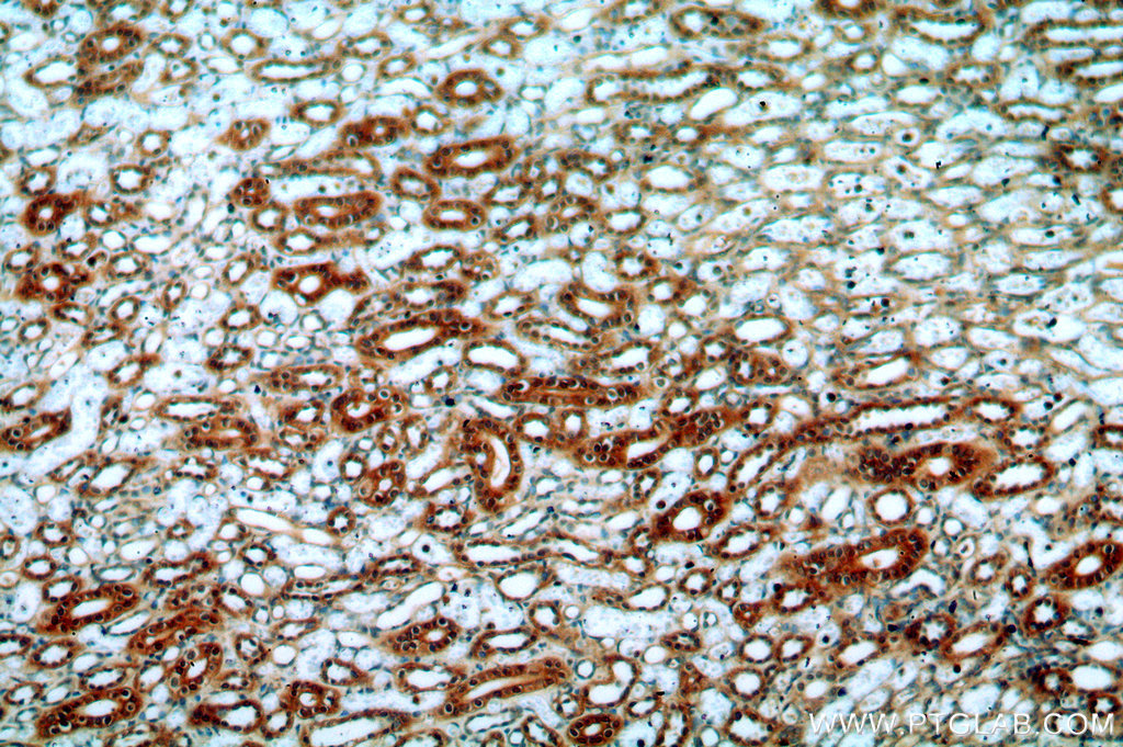 Immunohistochemical of paraffin-embedded human kidney using 20127-1-AP(FAM49B antibody) at dilution of 1:100 (under 10x lens)