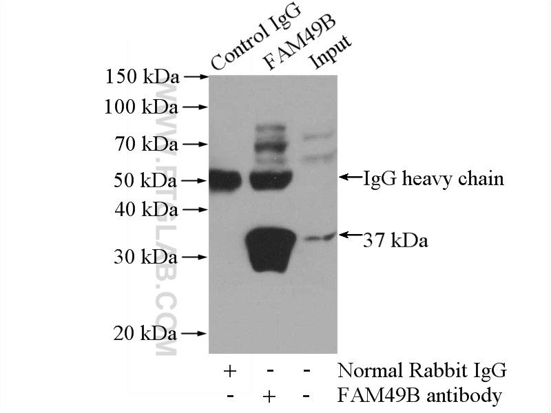 IP Result of anti-FAM49B (IP:20127-1-AP, 4ug; Detection:20127-1-AP 1:500) with mouse brain tissue lysate 4000ug.
