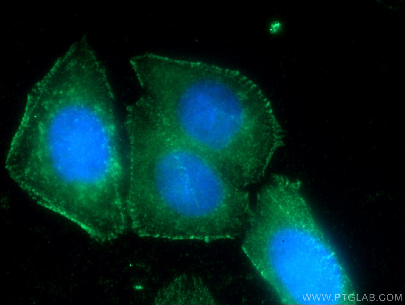 Immunofluorescent analysis of HepG2 cells using 21038-1-AP( FAM78A Antibody) at dilution of 1:50 and Alexa Fluor 488-congugated AffiniPure Goat Anti-Rabbit IgG(H+L)
