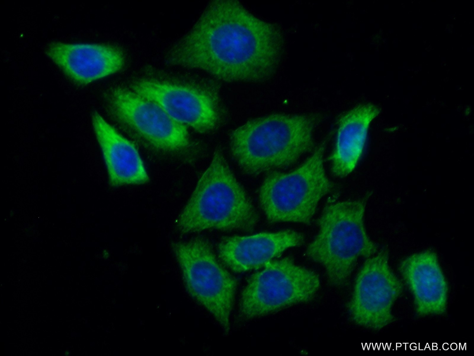 Immunofluorescent analysis of ( -20℃ Ethanol ) fixed HeLa cells using 24790-1-AP( GIGYF2 Antibody) at dilution of 1:50 and Alexa Fluor 488-congugated AffiniPure Goat Anti-Rabbit IgG(H+L)