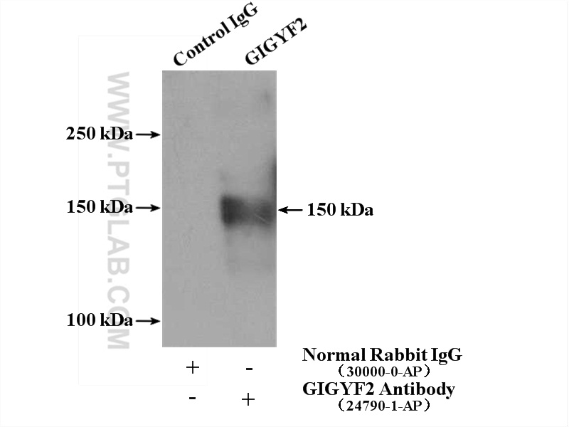 IP Result of anti-GIGYF2 (IP:24790-1-AP, 4ug; Detection:24790-1-AP 1:2000) with Jurkat cells lysate 2000ug.