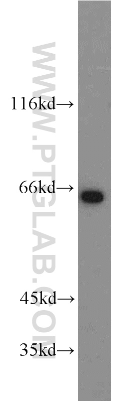 SH-SY5Y cells were subjected to SDS PAGE followed by western blot with 17797-1-AP(INPP5E antibody) at dilution of 1:1000