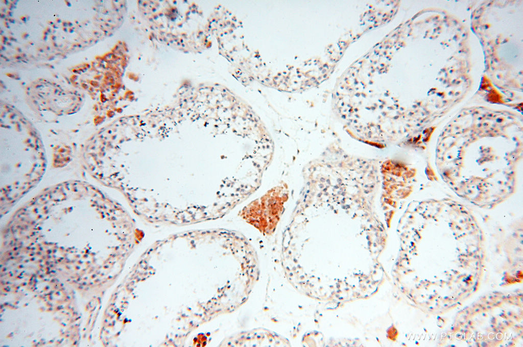 Immunohistochemical of paraffin-embedded human testis using 17797-1-AP(INPP5E antibody) at dilution of 1:50 (under 10x lens)