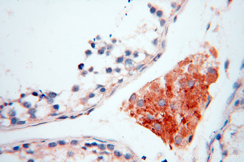 Immunohistochemical of paraffin-embedded human testis using 17797-1-AP(INPP5E antibody) at dilution of 1:50 (under 40x lens)