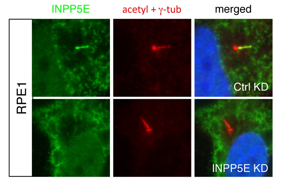 IF result of ciliary INPP5E in human hTERT-RPE1 cell: Upper is from control siRNA transfected cells and bottom is from INPP5E siRNA transfected cells. 17797-1-AP specifically recognizes the ciliary INPP5E(From Dr.Seongjin Seo).