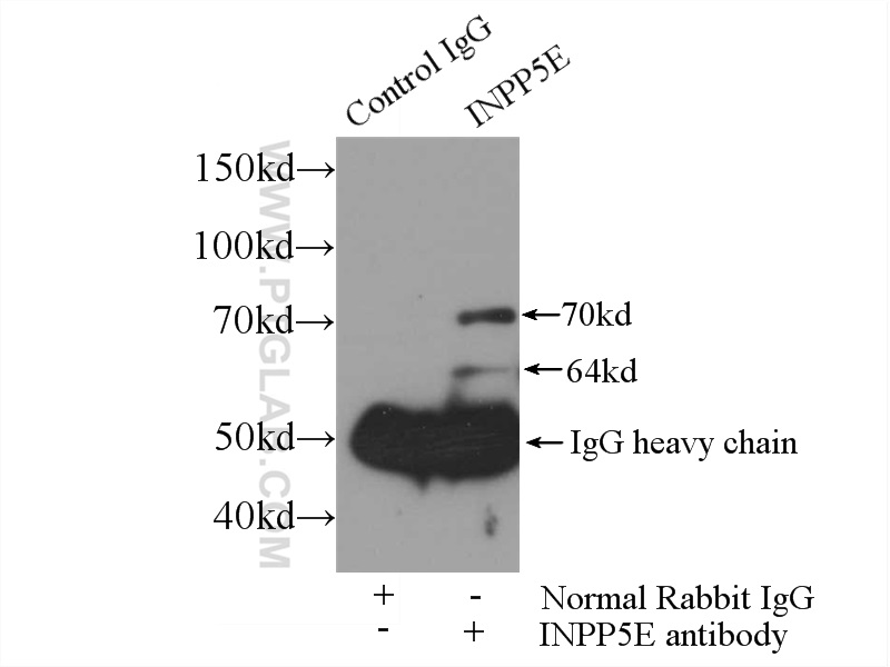 IP Result of anti-INPP5E (IP:17797-1-AP, 3ug; Detection:17797-1-AP 1:1000) with HEK-293 cells lysate 1000ug.