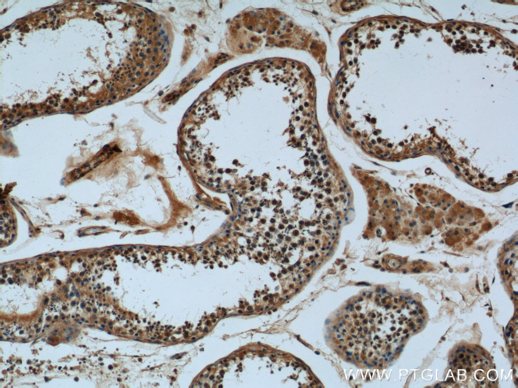 Immunohistochemistry of paraffin-embedded human testis tissue slide using 23345-1-AP( KDELC2 Antibody) at dilution of 1:50 (under 10x lens)