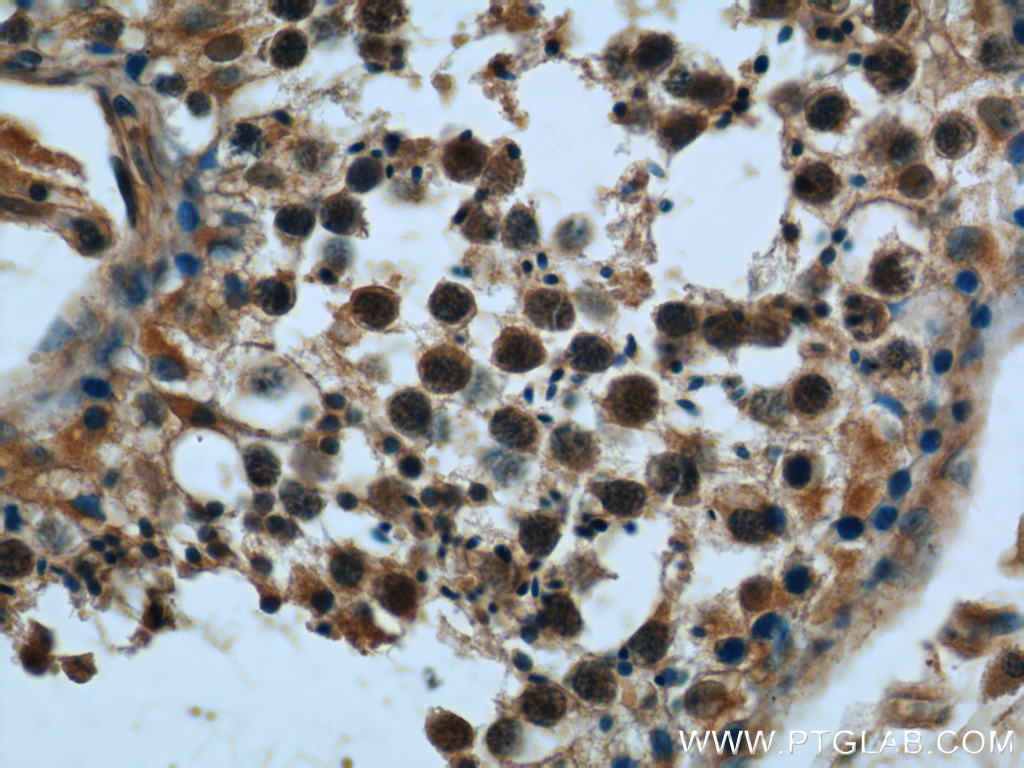 Immunohistochemistry of paraffin-embedded human testis tissue slide using 23345-1-AP( KDELC2 Antibody) at dilution of 1:50 (under 40x lens)