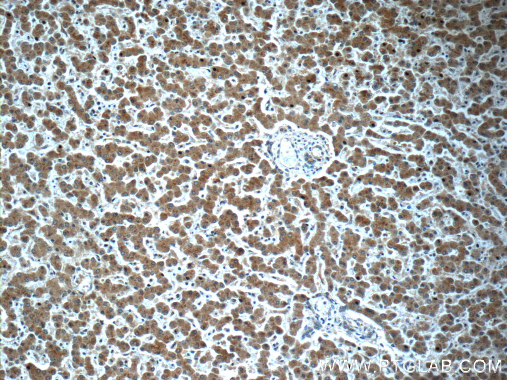 Immunohistochemistry of paraffin-embedded human liver slide using 23443-1-AP( KHDC1 Antibody) at dilution of 1:50 (under 10x lens)