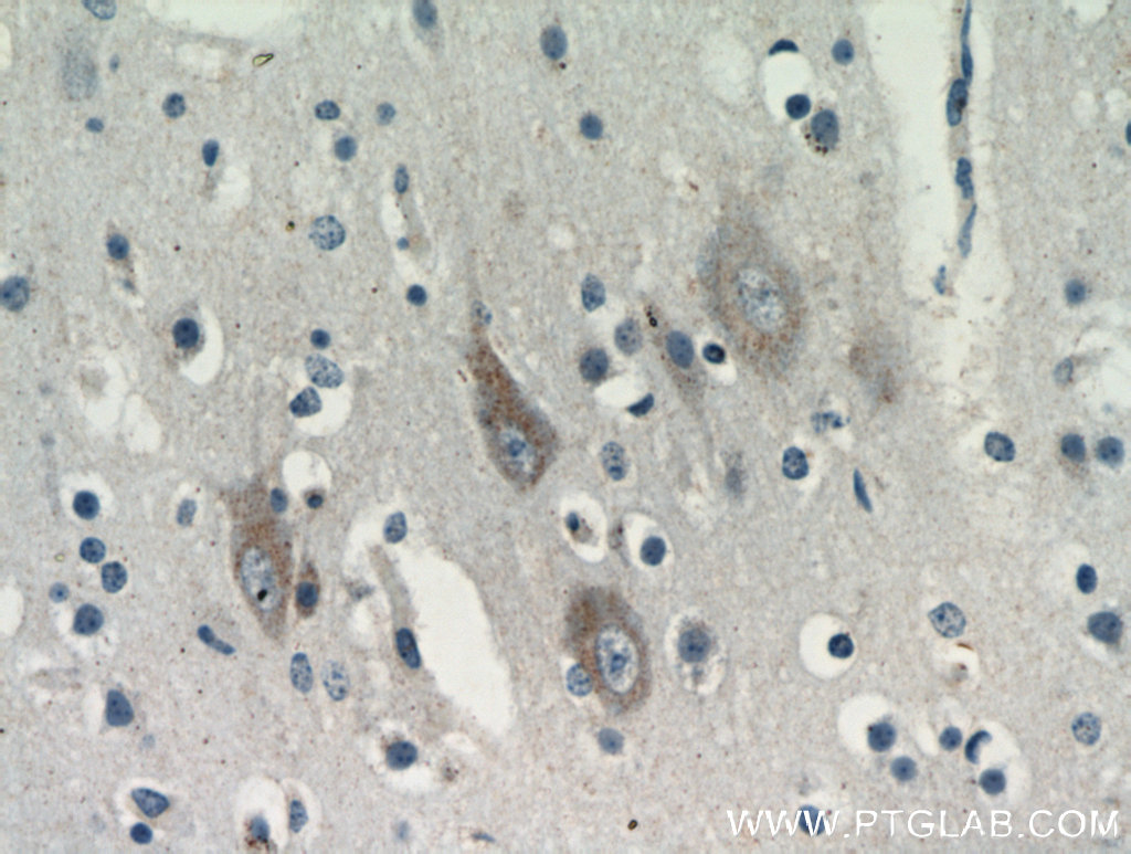 Immunohistochemical of paraffin-embedded human brain using 21016-1-AP(KIAA0319L antibody) at dilution of 1:100 (under 40x lens)