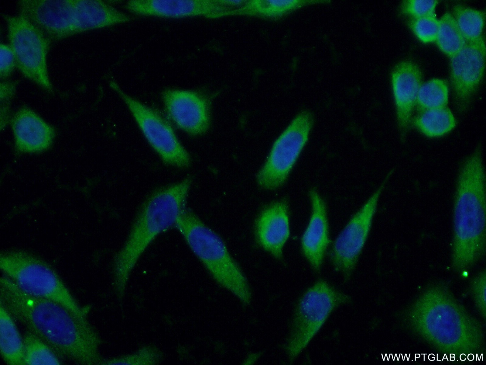 Immunofluorescent analysis of ( -20℃ Ethanol ) fixed HeLa cells using 21016-1-AP( KIAA0319L Antibody) at dilution of 1:50 and Alexa Fluor 488-congugated AffiniPure Goat Anti-Rabbit IgG(H+L)