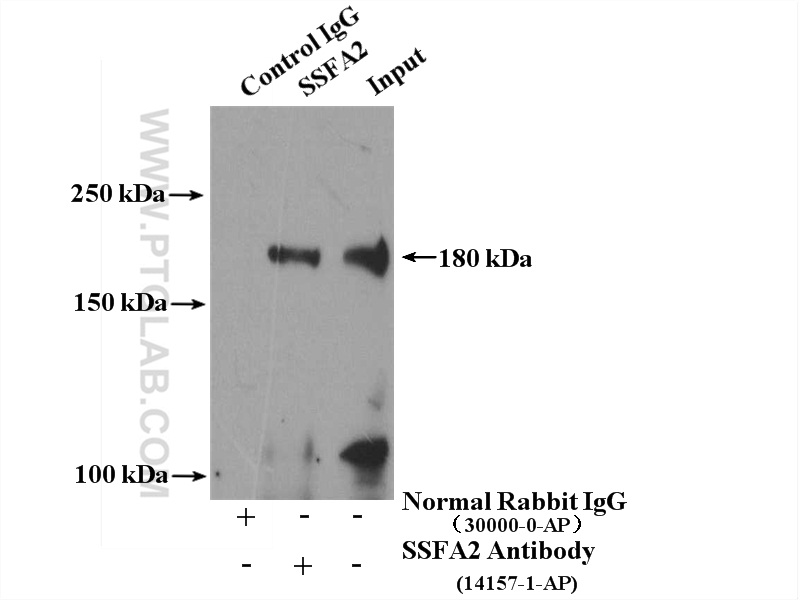 IP Result of anti-KRAP, SSFA2 (IP:14157-1-AP, 4ug; Detection:14157-1-AP 1:500) with mouse testis tissue lysate 4000ug.