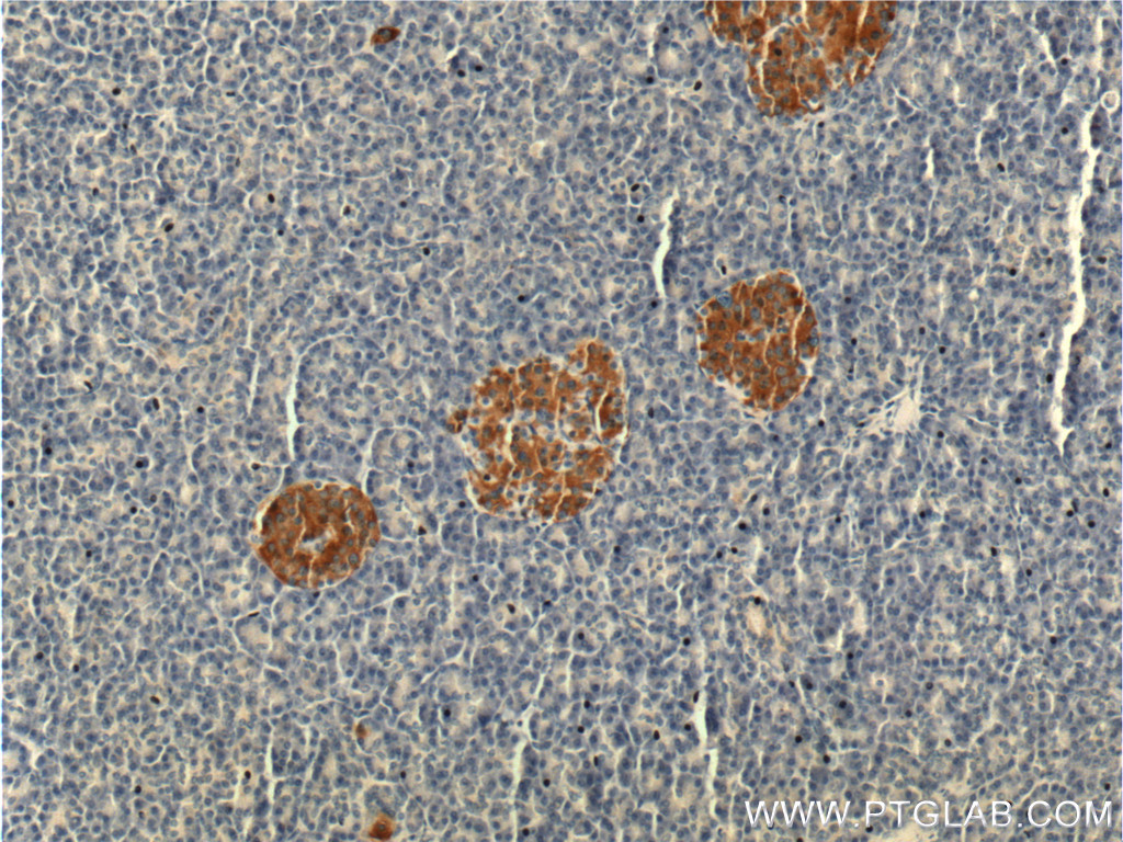 Immunohistochemistry of paraffin-embedded human pancreas tissue slide using 14157-1-AP( KRAP, SSFA2 Antibody) at dilution of 1:200 (under 10x lens).