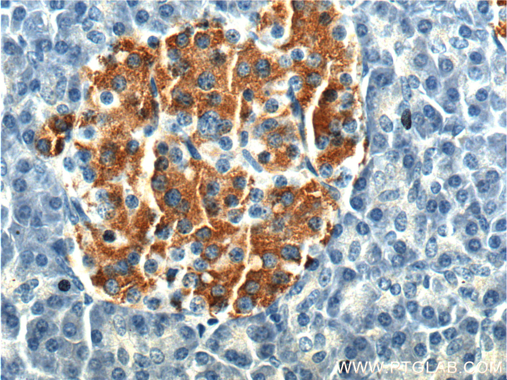 Immunohistochemistry of paraffin-embedded human pancreas tissue slide using 14157-1-AP( KRAP, SSFA2 Antibody) at dilution of 1:200 (under 40x lens).
