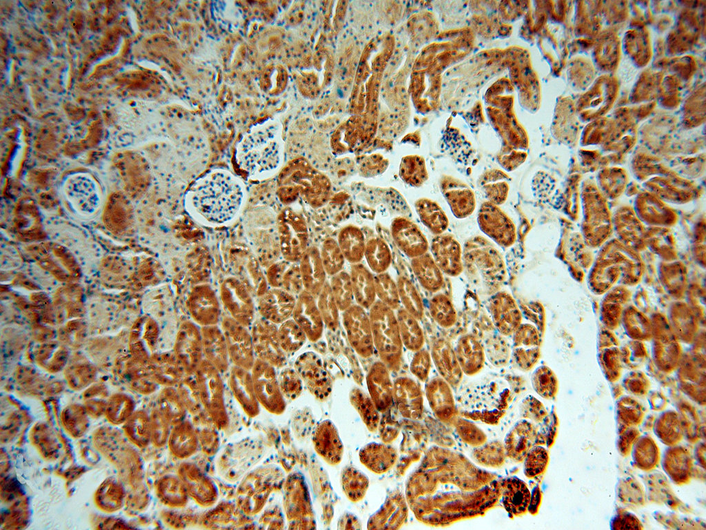 Immunohistochemical of paraffin-embedded human kidney using 15759-1-AP(LHPP antibody) at dilution of 1:100 (under 10x lens)