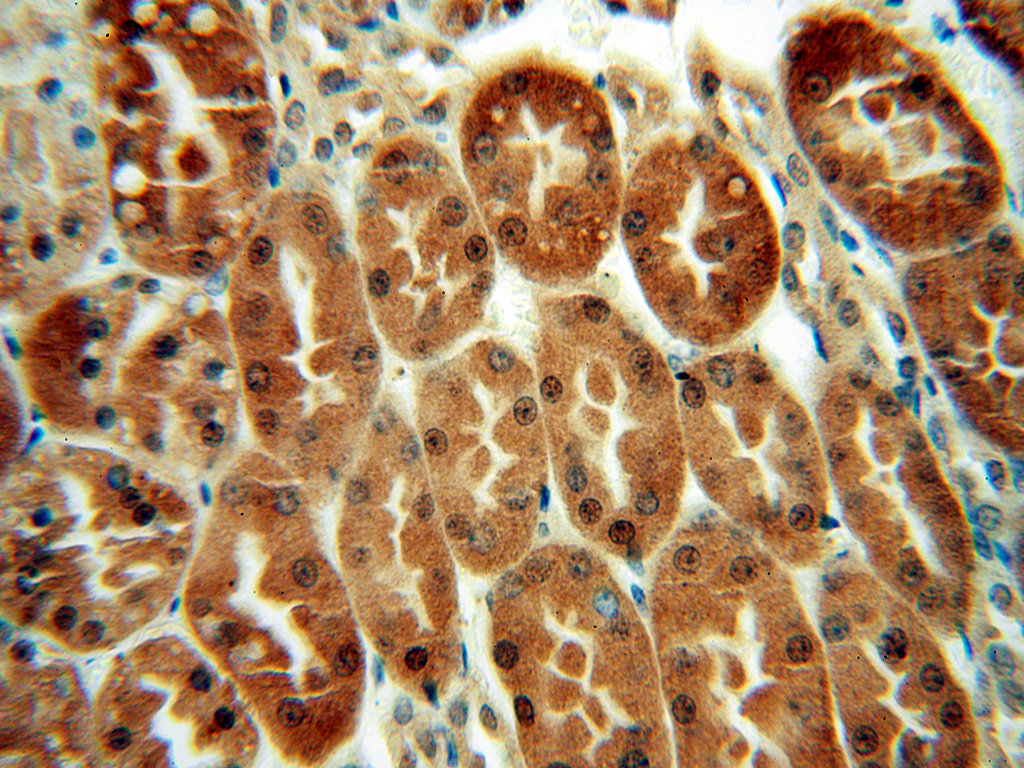 Immunohistochemical of paraffin-embedded human kidney using 15759-1-AP(LHPP antibody) at dilution of 1:100 (under 40x lens)