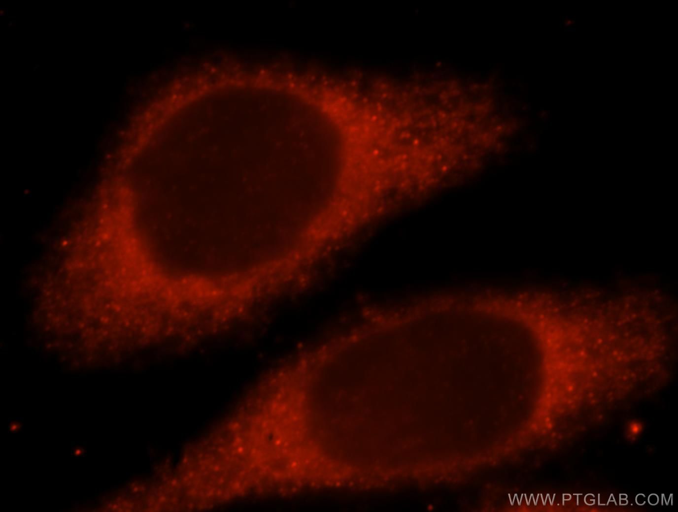 Immunofluorescent analysis of Hela cells, using LHPP antibody 15759-1-AP at 1:25 dilution and Rhodamine-labeled goat anti-rabbit IgG (red).