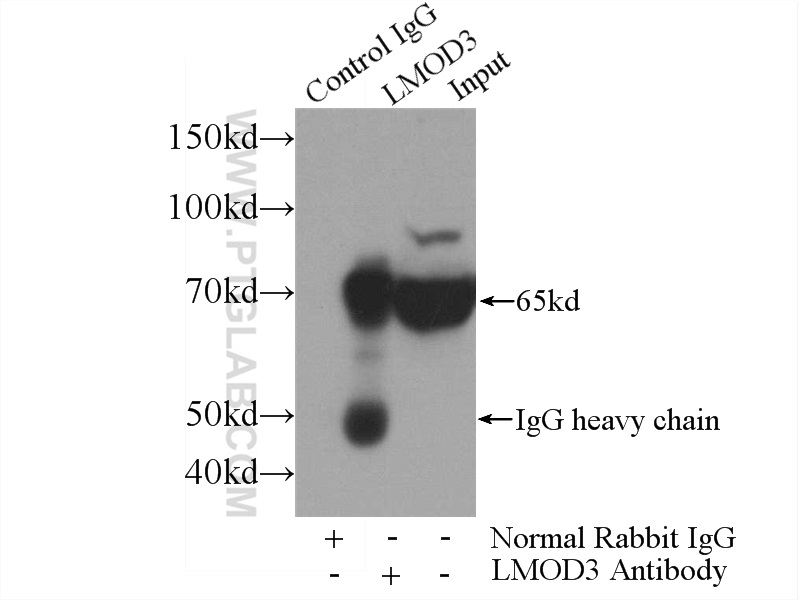 IP Result of anti-LMOD3 (IP:14948-1-AP, 4ug; Detection:14948-1-AP 1:700) with mouse skeletal muscle tissue lysate 3600ug.