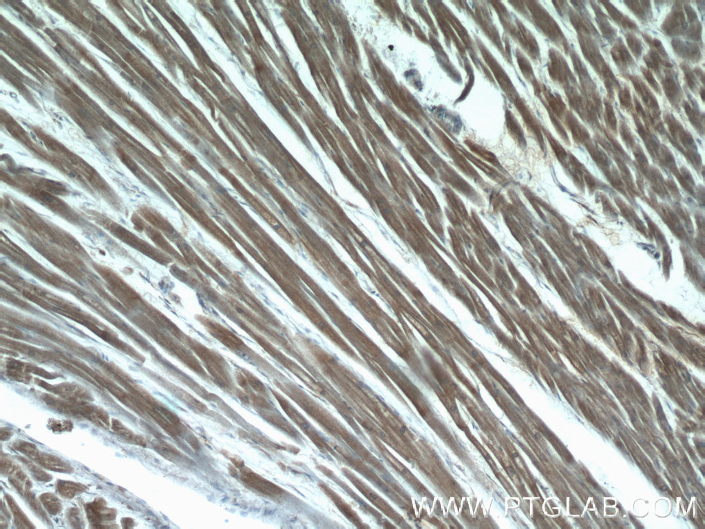 Immunohistochemistry of paraffin-embedded human heart tissue slide using 14948-1-AP( LMOD3 Antibody) at dilution of 1:50 (under 10x lens)