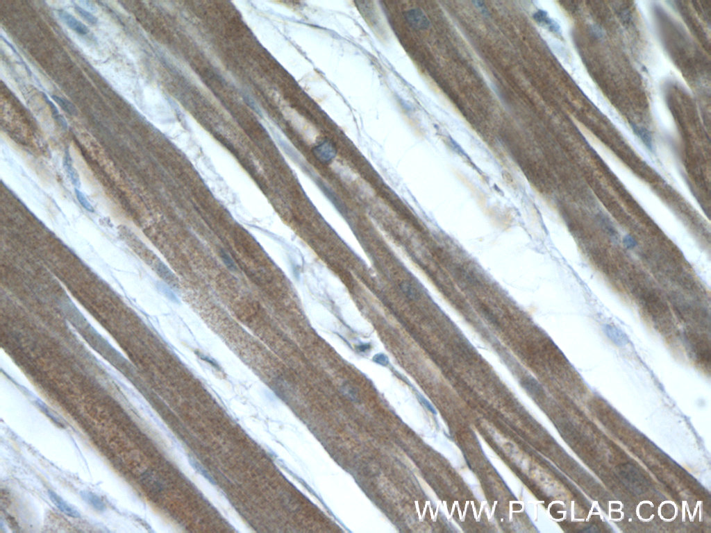 Immunohistochemistry of paraffin-embedded human heart tissue slide using 14948-1-AP( LMOD3 Antibody) at dilution of 1:50 (under 40x lens)