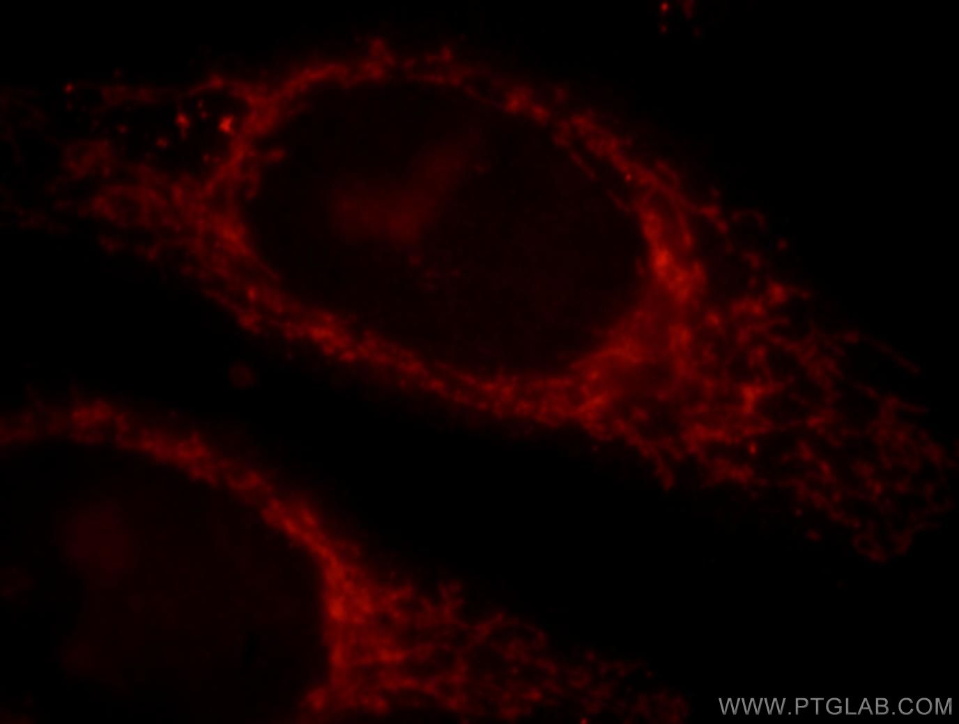 Immunofluorescent analysis of HepG2 cells, using MAPKBP1 antibody 17788-1-AP at 1:25 dilution and Rhodamine-labeled goat anti-rabbit IgG (red).