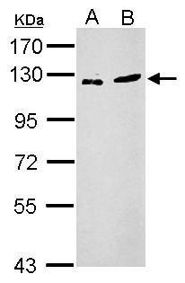 Sample (30 ug of whole cell lysate) A: PC-3 B: SK-N-SH 7.5% SDS PAGE diluted at 1:2000
