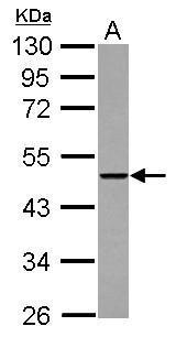 Sample (30 ug of whole cell lysate) A: A431 10% SDS PAGE diluted at 1:5000