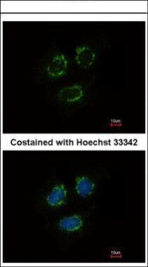 Immunofluorescence analysis of methanol-fixed MCF-7, using TTLL10 antibody at 1:500 dilution.