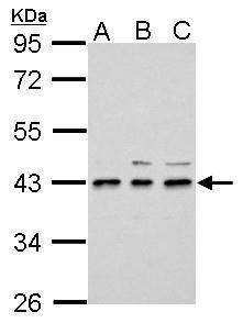 Sample (30 ug of whole cell lysate) A: 293T B: A431 C: HeLa 10% SDS PAGE diluted at 1:3000