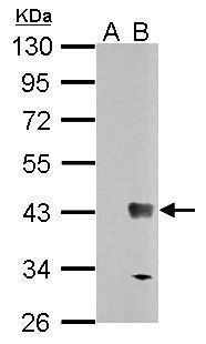 Sample (30 ug of whole cell lysate) A: Non-transfected 293T lysates B: WNT7B protein transfected 293T lysates 10% SDS PAGE Diluted at 1:5000