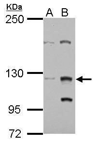 Sample (30 ug of whole cell lysate) A: Jurkat B: Raji 5% SDS PAGE diluted at 1:1000