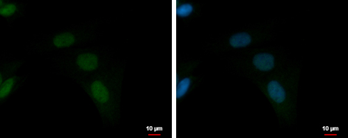 ZFAT antibody detects ZFAT protein at nucleus by immunofluorescent analysis.Sample: SKNSH cells were fixed in 4% paraformaldehyde at RT for 15 min.Green: ZFAT protein stained by ZFAT antibody diluted at 1:500.Blue: Hoechst 33342 staining.Scale bar = 10 um.