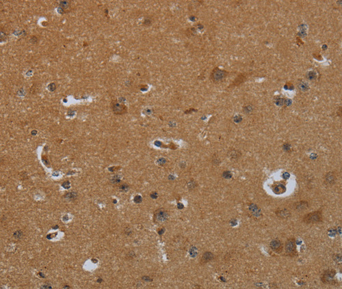 Immunohistochemistry of Human brain using ENTPD7 Polyclonal Antibody at dilution of 1:60
