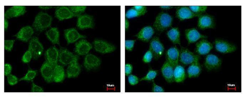 ALS2CR12 antibody detects ALS2CR12 protein at cytoplasm by immunofluorescent analysis. Sample: A431 cells were fixed in ice-cold Methanol for 5 min.Green: ALS2CR12 protein stained by ALS2CR12 antibody diluted at 1:500.Blue: Hoechst 33343 staining.