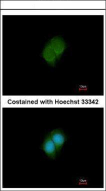 Immunofluorescence analysis of paraformaldehyde-fixed MCF-7, using ANKS3 antibody at 1:200 dilution.
