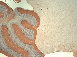 IHC analysis of IP3 Receptor . Intense positivity of the giant neurons and axonal fibers.