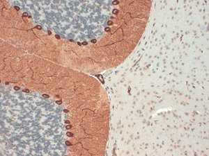 IHC analysis of IP3 Receptor . Intense positivity of the giant neurons and axonal fibers.