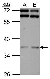 Sample (30 ug of whole cell lysate) A: NT2D1 B: SK-N-SH 10% SDS PAGE diluted at 1:3000
