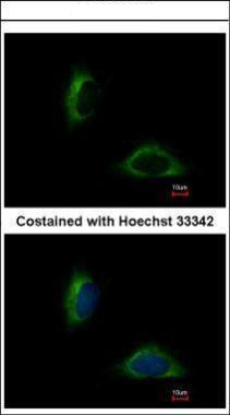 Immunofluorescence analysis of methanol-fixed HeLa, using FAM171A1 antibody at 1:500 dilution.